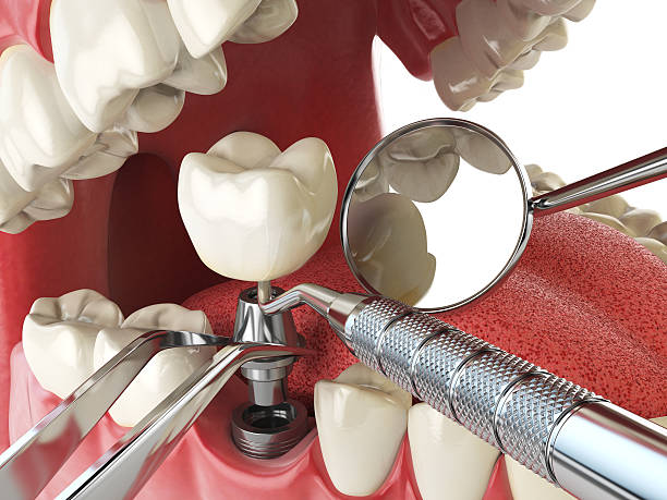  Lake Los Angeles, CA Emergency Dentist Pros